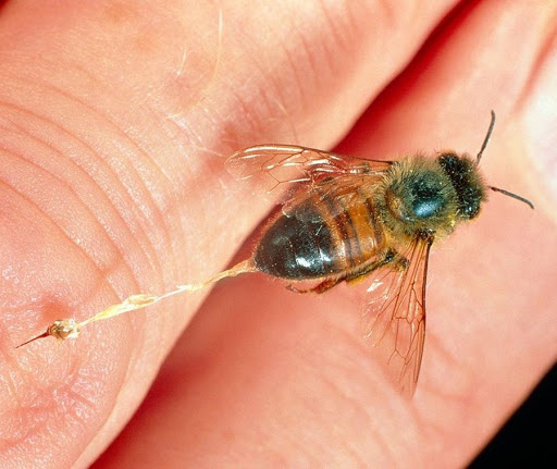 درمان سرطان پستان با سم زنبور عسل